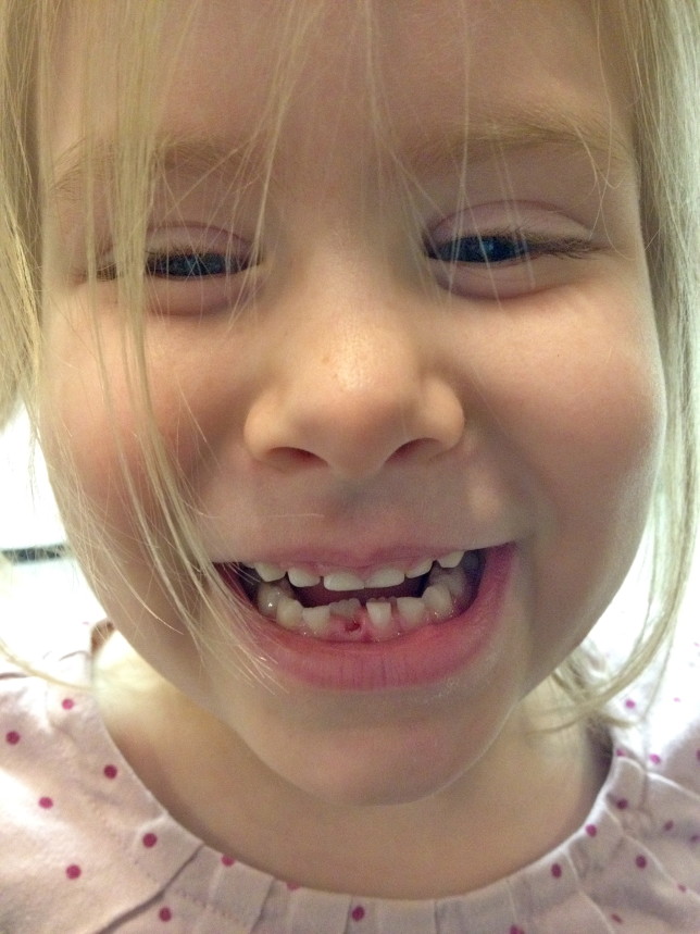 Kiera loses her first tooth! | Ribbons Undone